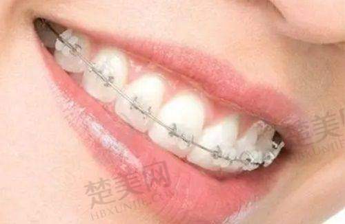 二、长春拜博口腔门诊部怎么样？