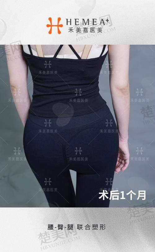 二、余恩旭做吸脂瘦脸的费用怎么算 - 2025价目表揭秘