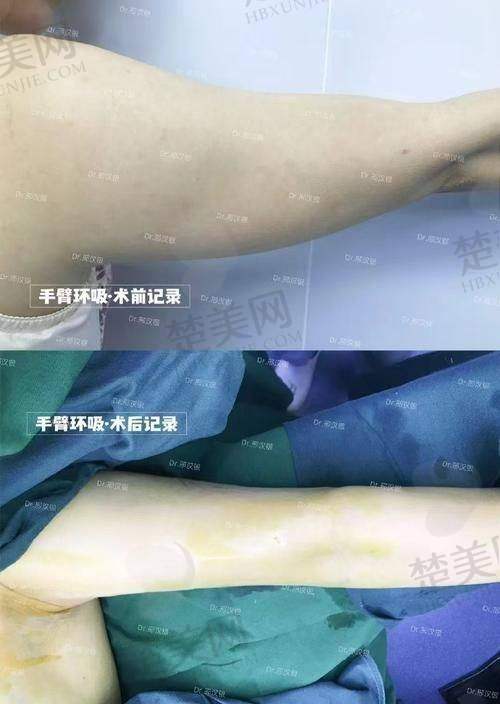五、口碑评价看赵希军 医生服务