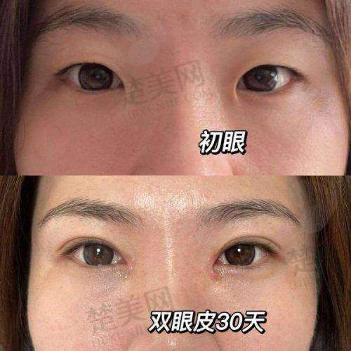一、广州米伦整形：华南医美界的闪亮之星