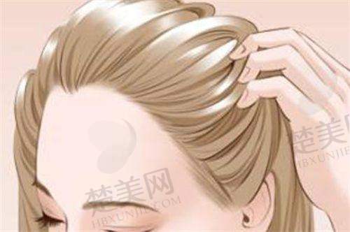 二、广东崇爱植发医院价格大揭秘