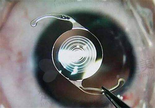 三、北京同仁眼科医院急诊绿色通道