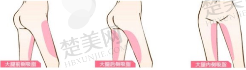 二、临沂微整美容医院怎么样?
