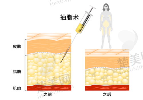 九、郑州郑东安琪儿医疗美容门诊部真实的患者评价