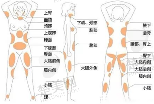 六、郑州郑东安琪儿医疗美容门诊部价格表