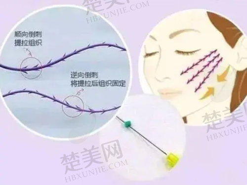 二、郑州郑东安琪儿医疗美容门诊部怎么样?