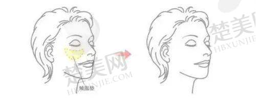 八、广州雅贝壹医疗美容门诊部预约方式