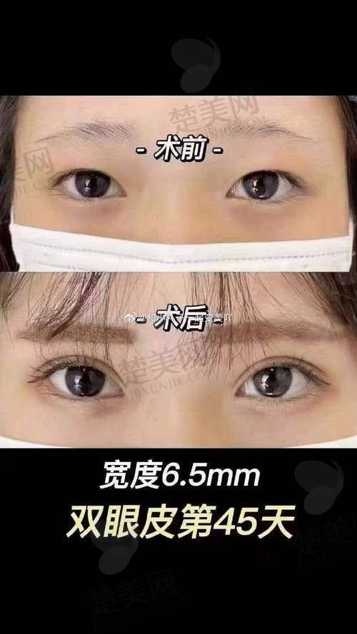 一、合肥吴丽丽医生简介