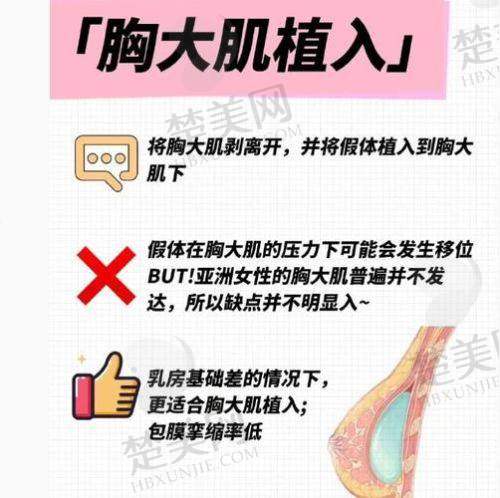 5. 隆胸失败修复