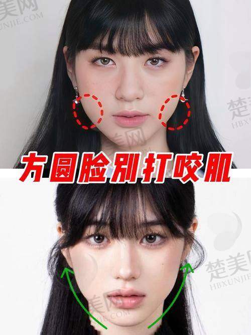 五、瘦脸注射的术前准备