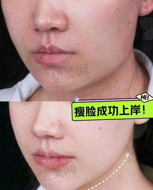 八、选择正规机构与医生