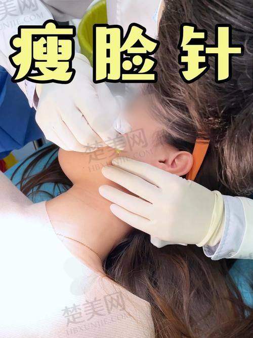 二、瘦脸注射几针能定型