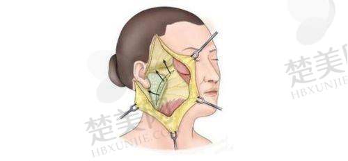 5. 综合年轻化