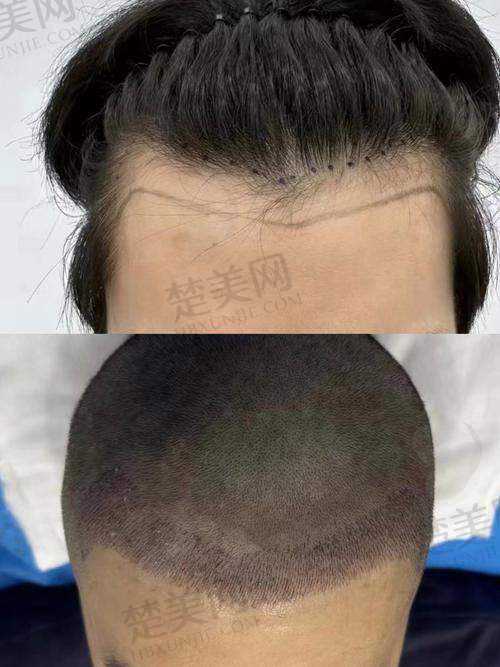 五、广东崇爱植发医院详细地址及乘车路线