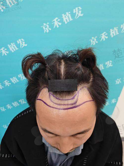 六、北京碧莲盛植发的行业竞争优势