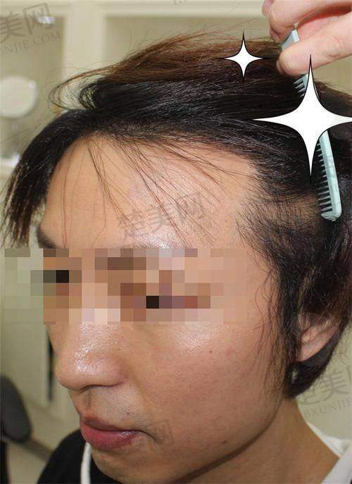 一、北京碧莲盛植发医院的基本情况