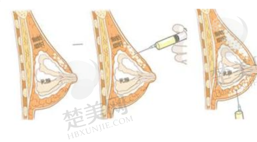 三、北京零度佳仪医疗美容诊所诊疗项目有哪些？
