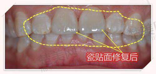 四、北京诺美口腔门诊部诊疗项目有哪些？