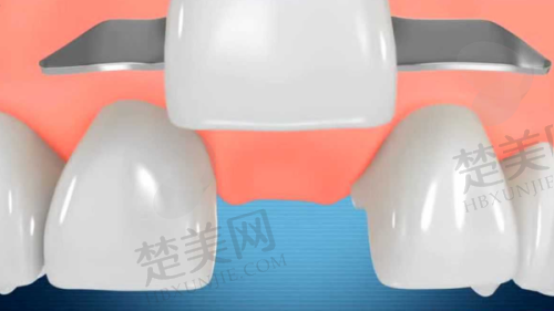 五、北京柠檬树口腔诊所医生介绍