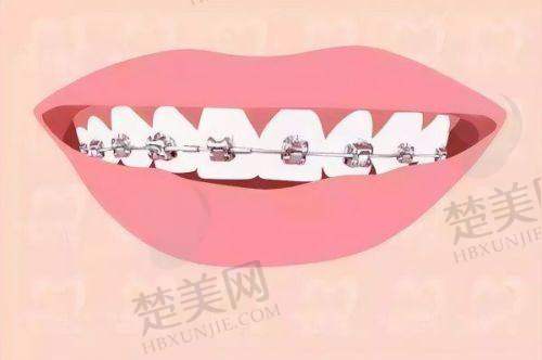 三、北京诺美口腔门诊部怎么样？