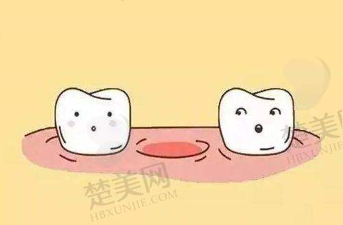 九、北京柠檬树口腔诊所真实的患者评价