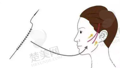二、北京零度佳仪医疗美容诊所怎么样？