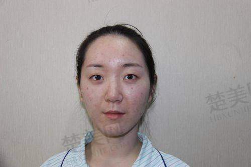 三、李瑞萱医生技术怎么样？