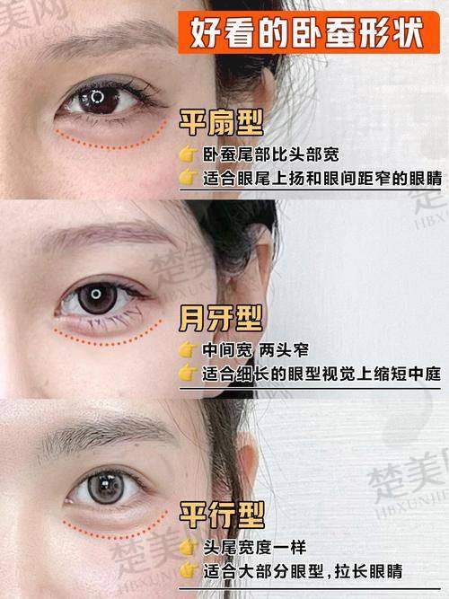 四、卧蚕填充材料的搭配选择