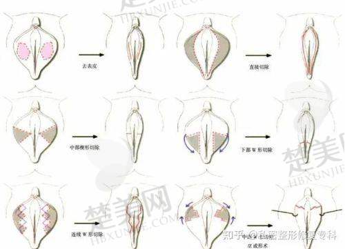 八、上海虹桥医院私密科预约方式