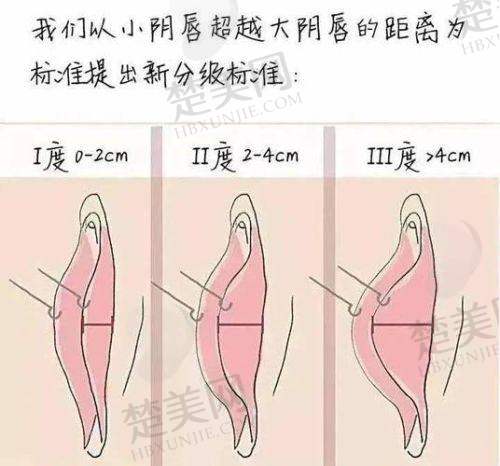 一、上海虹桥医院私密科正规吗?