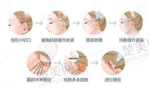 八、重庆华美紫馨整形美容医院预约方式