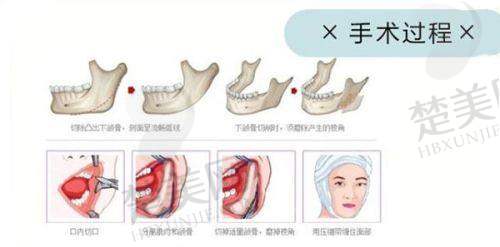 三、荥阳京城朵姿医疗美容诊所诊疗项目有哪些？