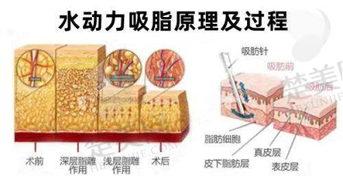 二、重庆华美紫馨整形美容医院怎么样?