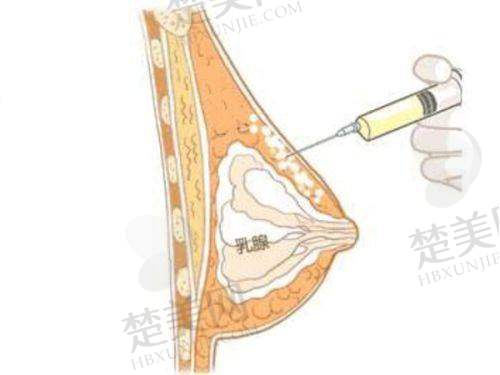 二、荥阳京城朵姿医疗美容诊所怎么样？