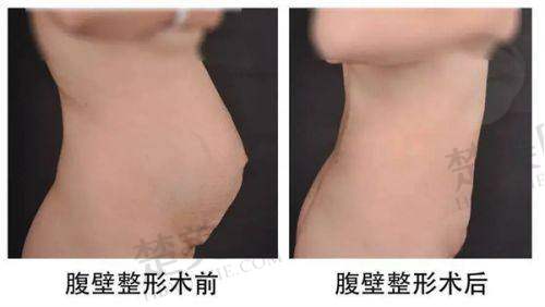 五、怎么去长沙鹏爱医院找张巍医生