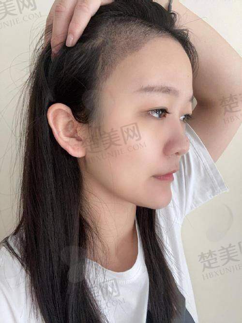 九、重庆唐森医疗美容诊所真实的患者评价