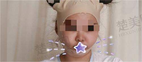 九、深圳爱唯医疗美容门诊部真实的患者评价
