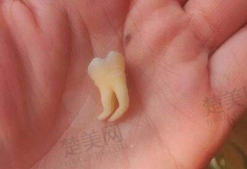 九、乌鲁木齐豪雅仁口腔诊所真实的患者评价