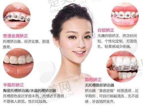 四、商丘恒美口腔门诊部特色项目