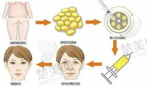 八、深圳爱唯医疗美容门诊部预约方式