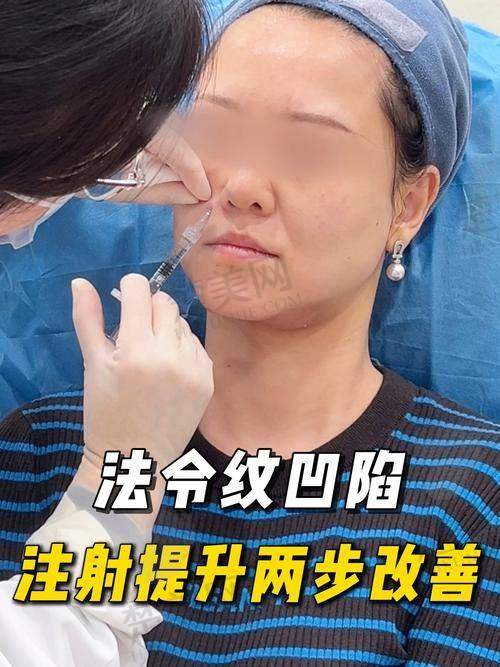 三、日常护理祛抬头纹