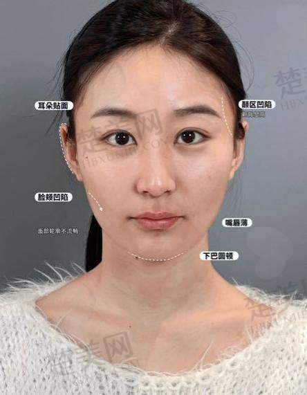 五、乔雅登极致的使用体验和注意事项
