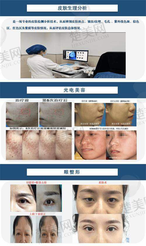 三、赣州市人民医院皮肤科：规模大、技术强的激光美容中 心