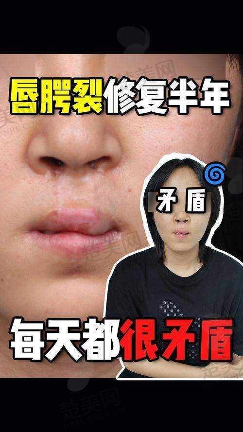 一、成都现代医美李献和医生个人风采