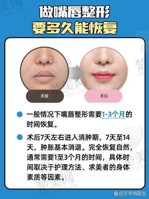 三、不同类型M唇手术的具体价格及适合人群