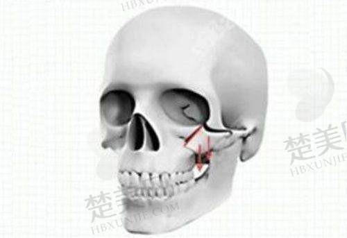 三、邯郸京美医疗美容门诊部诊疗项目有哪些？