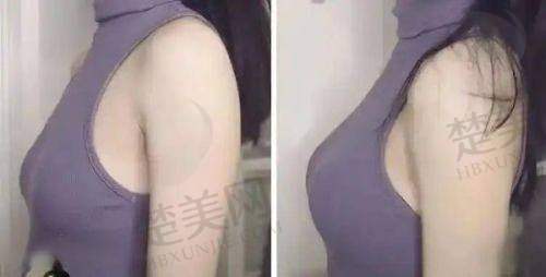 一、彭义坤医生简介