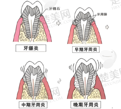 四、临汾青杰口腔诊所特色项目