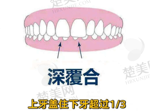 四、商丘永城友谊口腔医院特色项目