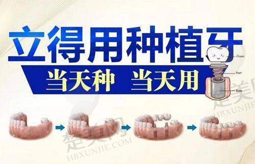 威海华怡口腔门诊部预约方式